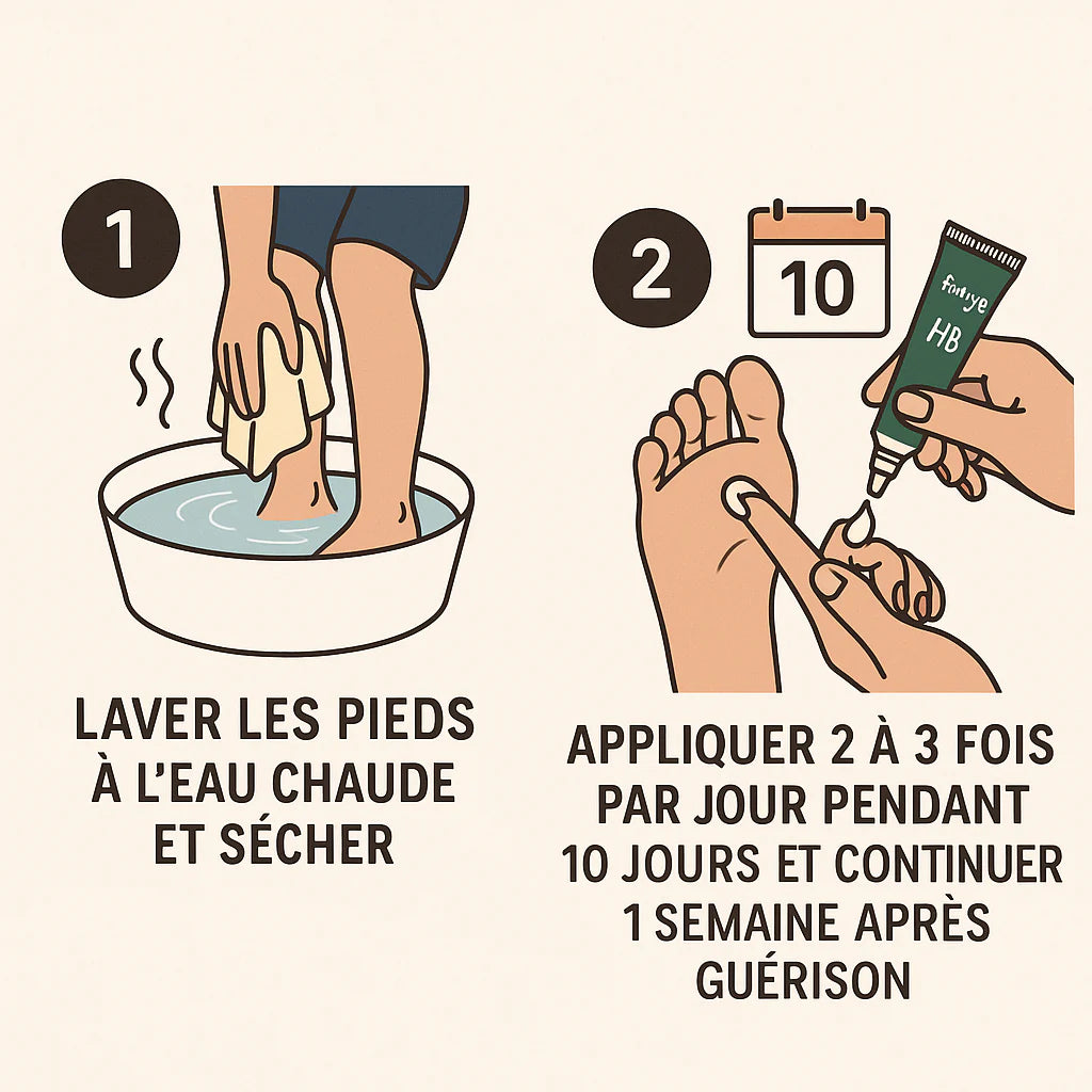 Crème contre le pied d’athlètes et la mycose des pieds : pour Hommes et Femmes