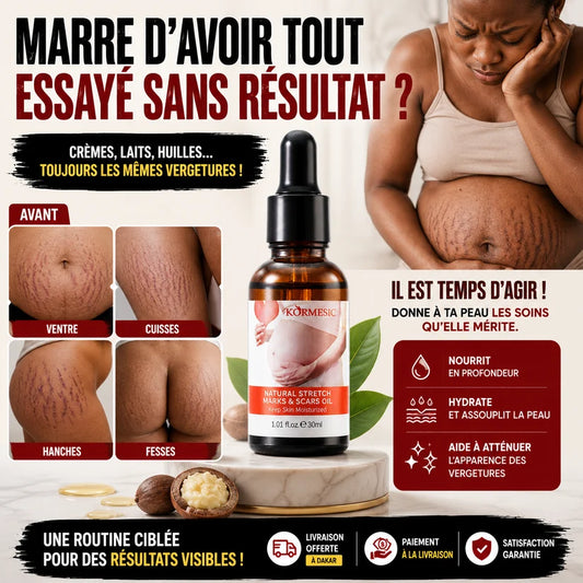L’HUILE ULTIME QUI AIDE À METTRE FIN À L’APPARENCE DES VERGETURES EN SEULEMENT 30 JOURS FACILEMENT !!!