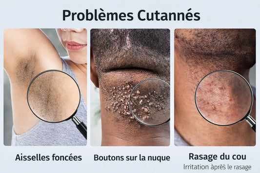 ✨ DITES STOP AUX POILS INCARNÉS AU BOUTON APRES RASAGE UNE BONNE FOIS POUR TOUTES
